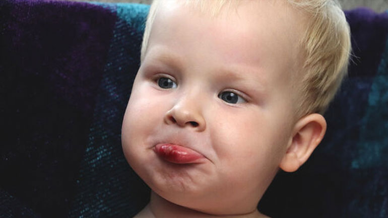 Ο επιχείλιος έρπης στα παιδιά