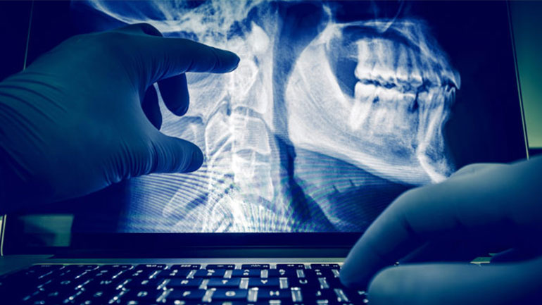 ΕΕ: 35 εκατ. ευρώ στην ανάπτυξη λύσεων τεχνητής νοημοσύνης για την πρόληψη κατά του καρκίνου