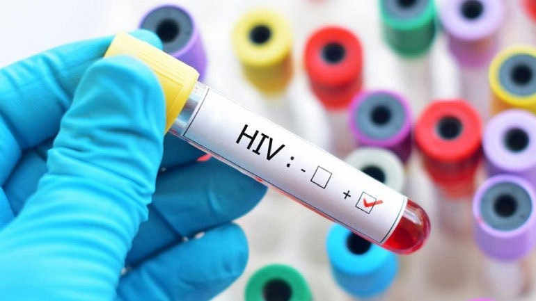ΟΗΕ: Σχεδόν 770.000 οι νεκροί από το AIDS το 2018