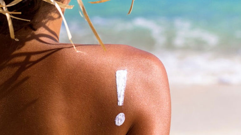 Ηλιακό έγκαυμα: Τα αιθέρια έλαια που καταπραΰνουν το τσούξιμο