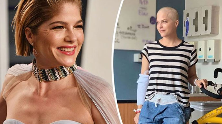 Η Selma Blair ξύρισε το κεφάλι της – Υποβάλλεται σε νέα θεραπεία για την σκλήρυνση κατά πλάκας