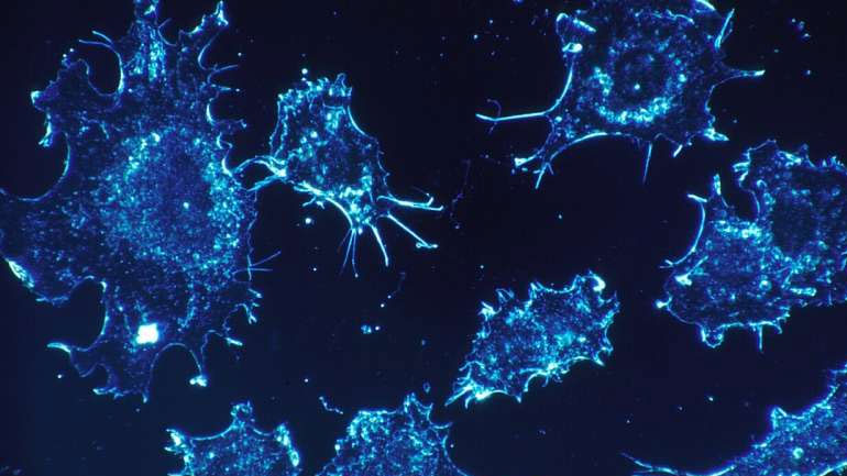 Η χρήση αντιβιοτικών αυξάνει τον κίνδυνο εμφάνισης καρκίνου του εντέρου