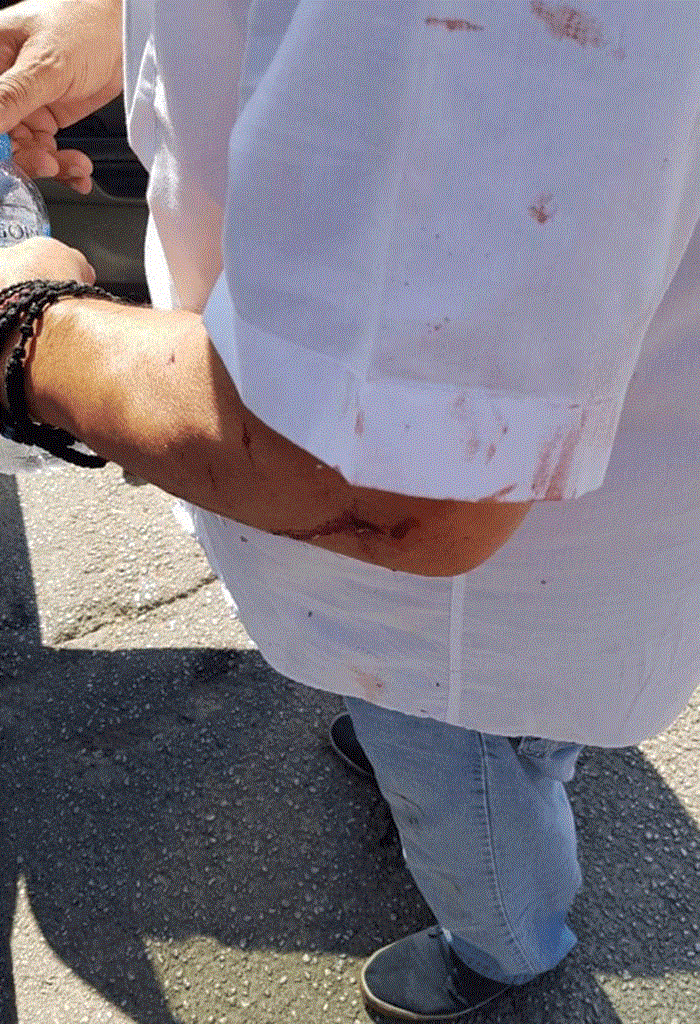 Στη φωτογραφία απεικονίζεται ο ιδιοκτήτης της οικίας τραυματισμένος