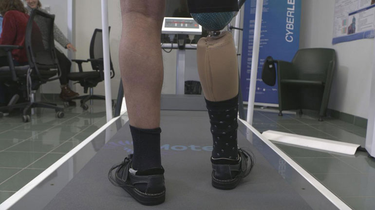 Ακρωτηριασμένοι άνθρωποι αποκτούν ξανά αισθήσεις στο νέο προσθετικό πόδι τους