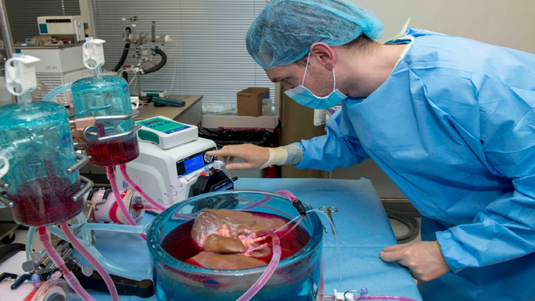 Μια νέα βελτιωμένη μέθοδος συντήρησης οργάνων, ανοίγει αυξημένες δυνατότητες για τις μεταμοσχεύσεις,