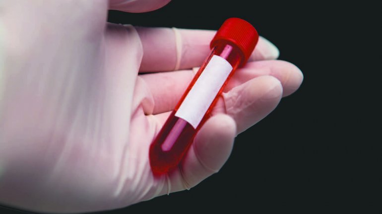 Η φλεγμονή στα τέλη της εφηβείας συνδέεται με τον κίνδυνο θνησιμότητας τρεις δεκαετίες αργότερα