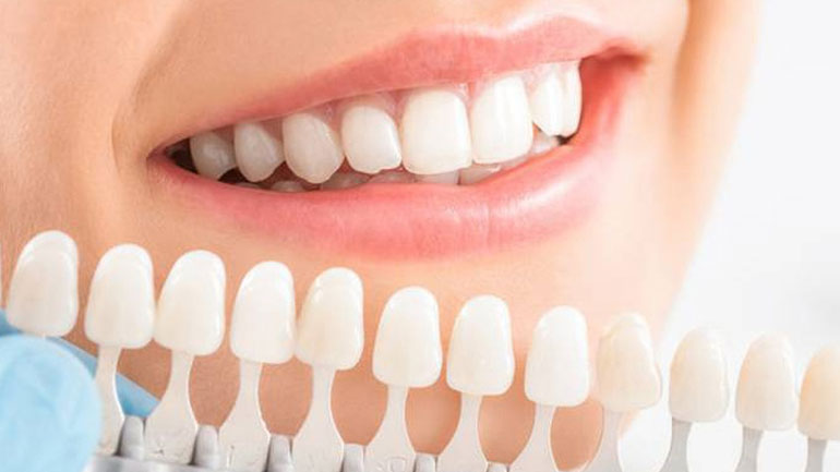 Γιατί τα δόντια αλλάζουν χρώμα;