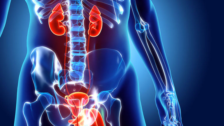 Ποιες αλλαγές στη διατροφή ενδέχεται να ανακουφίσουν από τα συμπτώματα της υπερδραστήριας κύστης;