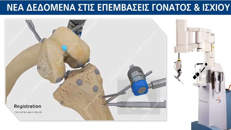 Ρομπότ στην υπηρεσία της Ορθοπαιδικής
