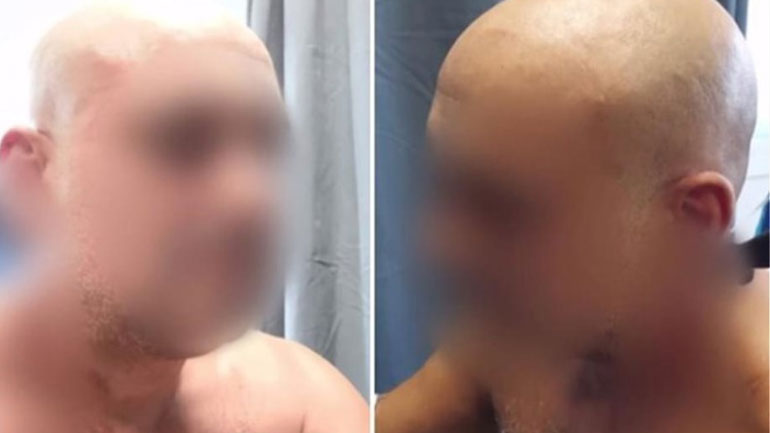 Καλαμάτα: Μαχαίρωσε τον κουμπάρο της – «Κάρφωσα τον διάβολο»