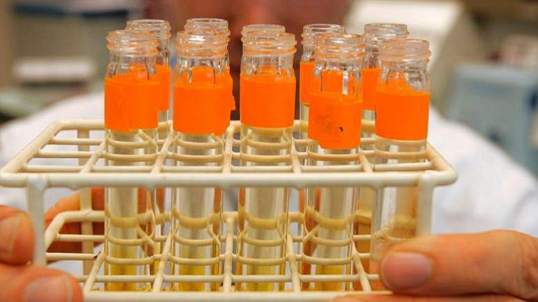 Η WADA ανακάλεσε την πιστοποίηση του εργαστηρίου ντόπινγκ του ΟΑΚΑ