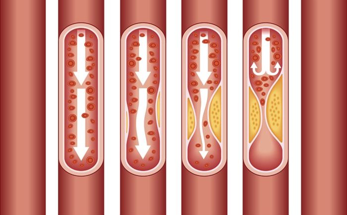 Σωματίδια που μοιάζουν με οστά ταξιδεύουν στην κυκλοφορία του αίματος