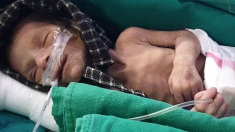 Νεογέννητο βρέφος βρέθηκε ζωντανό σε τάφο στην Ινδία