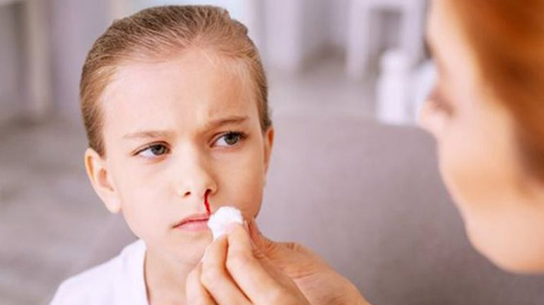 Πώς θα αντιμετωπίσετε τη ρινορραγία του παιδιού σας;
