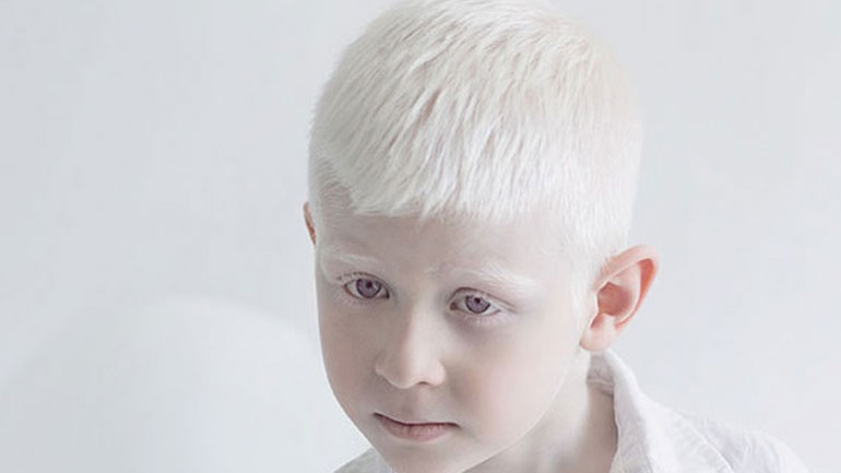 Τι ακριβώς είναι ο αλφισμός και πώς εκδηλώνεται;