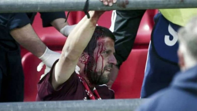 Τα πρόσωπα των ”φιλάθλων” πίσω από την κουκούλα…