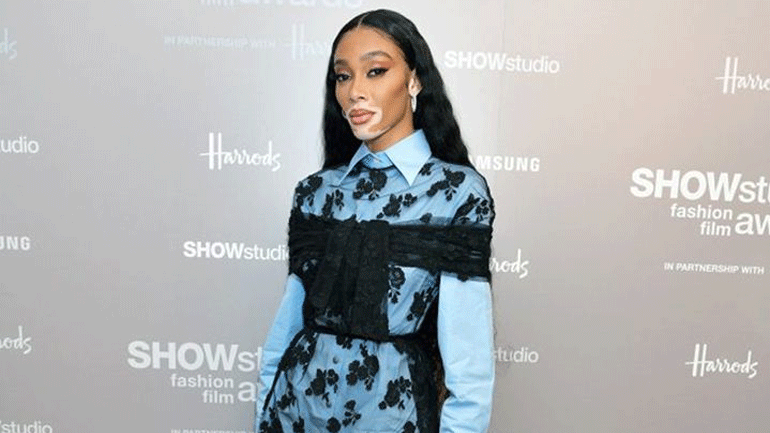 Winnie Harlow: Ερωτευμένη με γνωστό τραγουδιστή!