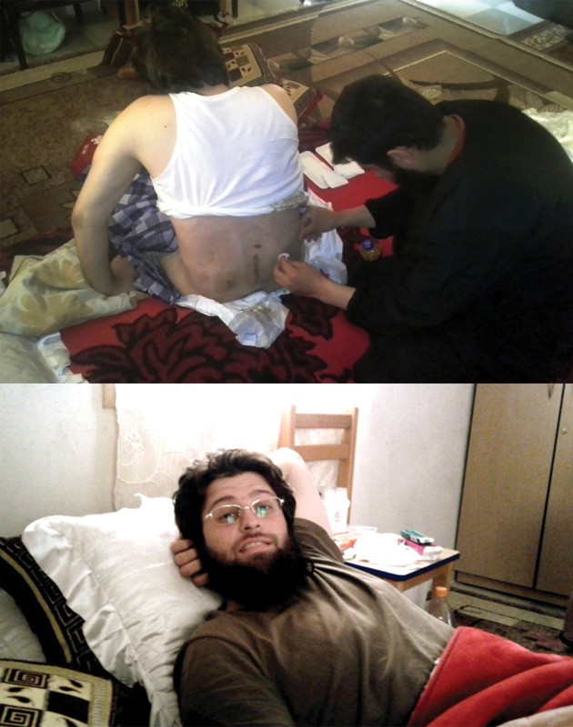 To 2014 τραυματίας στο Χαλέπι της Συρίας
