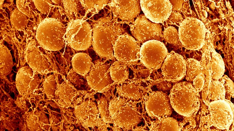 Το καστανό σωματικό λίπος εκκρίνει 100 πρωτεΐνες