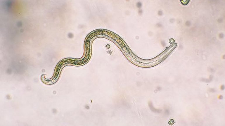 Γυναίκα βρήκε παρασιτικά σκουλήκια στα μάτια της, αφού έτρεξε μέσα από ένα σμήνος μύγες