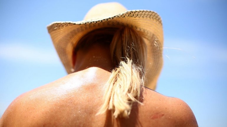 Πώς η ηλιοφάνεια προκαλεί μελάνωμα; Εξαρτάται από τα γονίδιά σας
