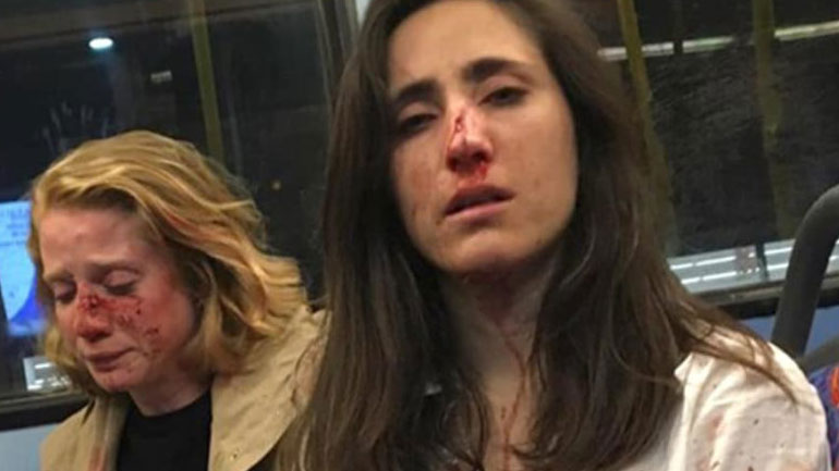 Λονδίνο: Η στιγμή της επίθεσης στις δύο γυναίκες που αρνήθηκαν να φιληθούν