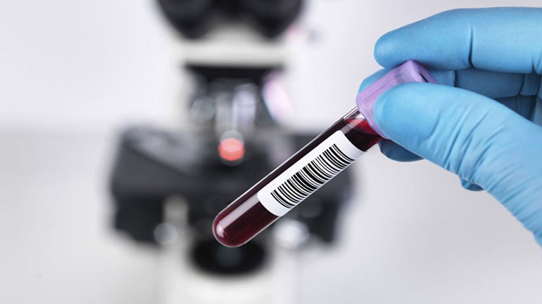 Κάθειρξη 25 ετών σε Αμερικανίδα που δηλητηρίασε τον σύζυγό της με κολλύριο