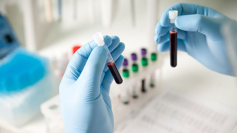 Ανακαλύφθηκε το πρώτο τεστ αίματος που προβλέπει πότε μία γυναίκα εισέρχεται σε εμμηνόπαυση