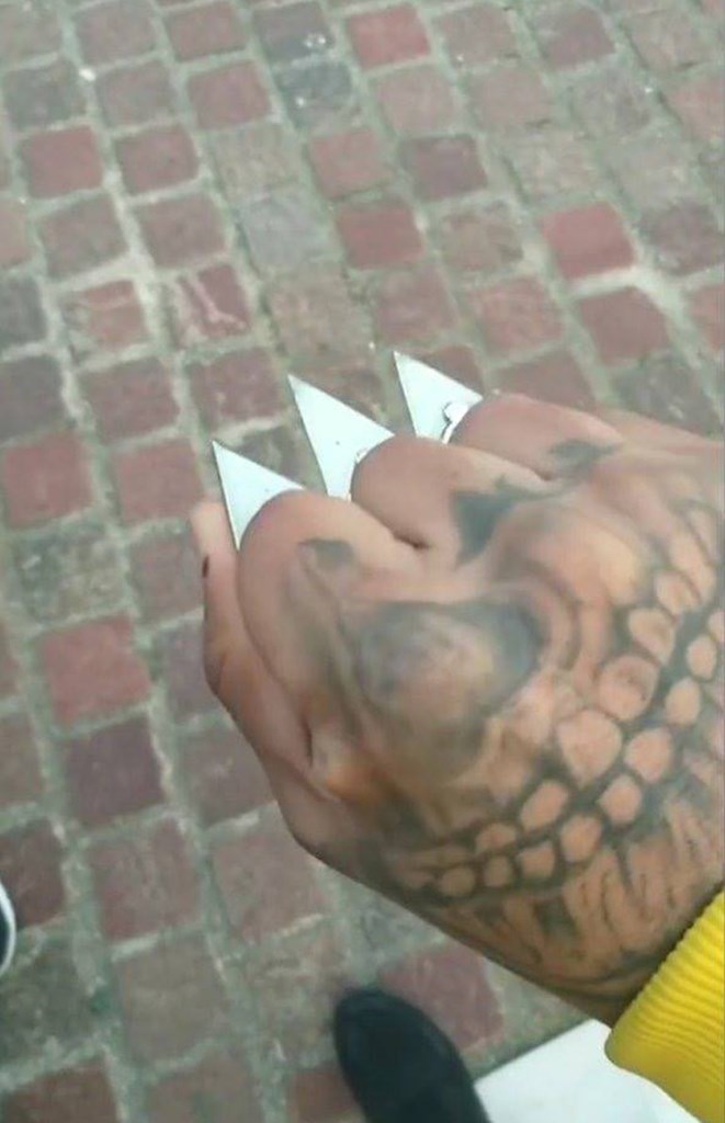 Αιχμηρή σιδηρογροθιά, για ακόμα μεγαλύτερη ζημιά στο θύμα