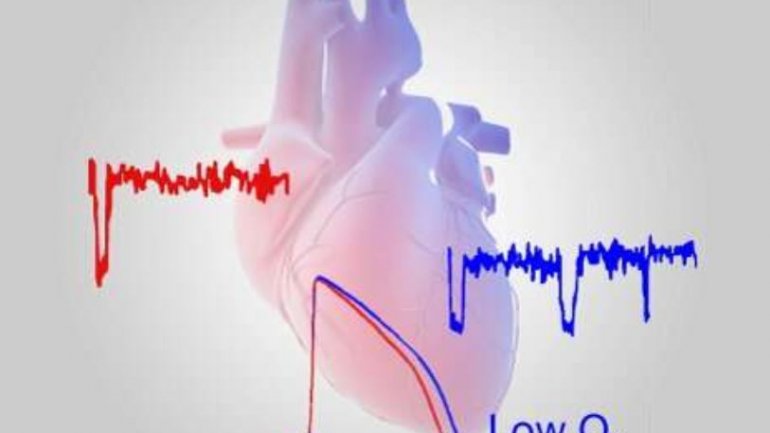 Τα χαμηλά επίπεδα οξυγόνου στην καρδιά προδιαθέτουν για καρδιακές αρρυθμίες