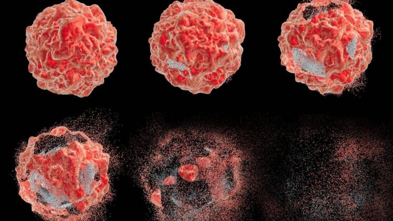 EΛΛΟΚ :  Το σχέδιο νόμου του Υπουργείου Υγείας δεν κάνει καμία αναφορά για τον καρκίνο