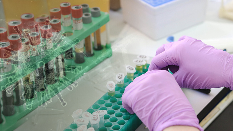 Επιβεβαιώθηκε πέμπτο κρούσμα κορωνοϊού Επιβεβαιώθηκε πέμπτο κρούσμα κορωνοϊού