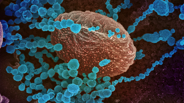 Ο Λίβανος ανακοίνωσε τρία νέα κρούσματα του Covid-19