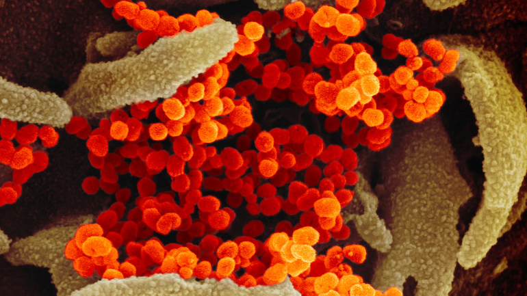 Πακιστάν: Στους τέσσερις ανέρχονται οι ασθενείς, καθώς εντοπίστηκαν άλλα δύο κρούσματα