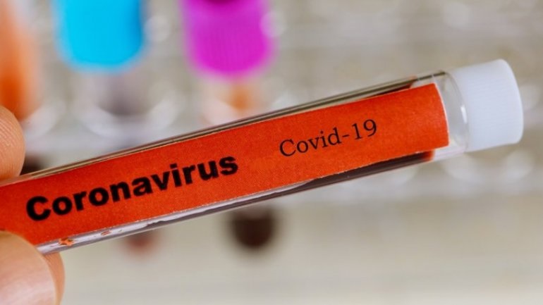 Οι σκύλοι μπορούν να κολλήσουν τον κορωνοϊό – Δεν υπάρχουν στοιχεία ότι τον μεταδίδουν – Απαραίτητη η καραντίνα