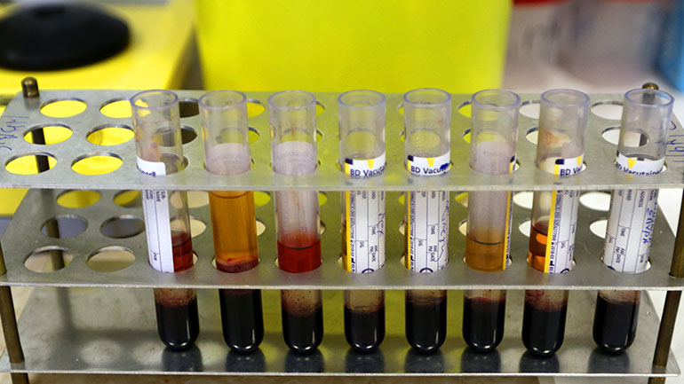 Άμεση ανάγκη για αιμοπετάλια