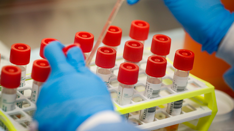 Κορωνοϊός: Η Αυστρία θα αυξήσει τον αριθμό των τεστ διάγνωσης μέχρι και σε 15.000 ημερησίως Κορωνοϊός: Η Αυστρία θα αυξήσει τον αριθμό των τεστ διάγνωσης μέχρι και σε 15.000 ημερησίως