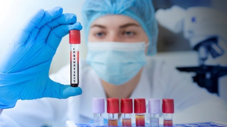 Τι ισχύει με τα ιδιωτικά τεστ για τη διάγνωση του κορωνοϊού