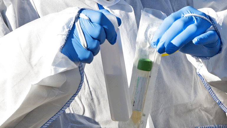 Aντισώματα κατά του κορωνοϊού απομόνωσαν Κινέζοι επιστήμονες