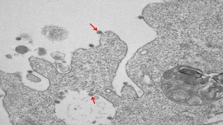 Μιλάνο: Στη δημοσιότητα φωτογραφία του κορωνοϊού από ηλεκτρονικό μικροσκόπιο