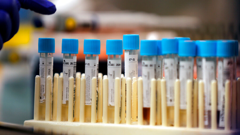 Νέο τεστ για τον κορωνοϊό υπόσχεται διάγνωση σε δύο ώρες