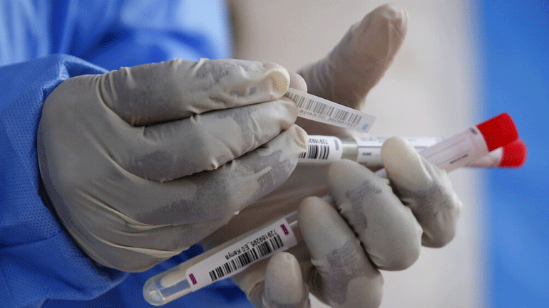 Βοσνία-Ερζεγοβίνη: Στους 23 οι νεκροί από τον κορωνοϊό