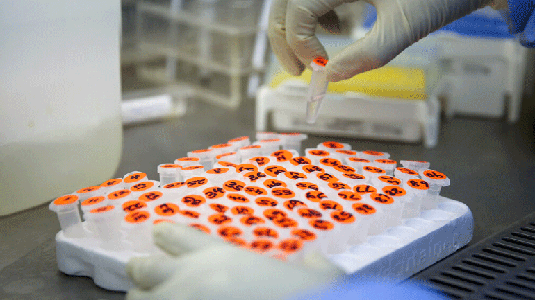 Διευθυντής Ινστιτούτου Παστέρ:  «Το φθινόπωρο ίσως να έχουμε τα πρώτα εμβόλια για τον κορωνοϊό»