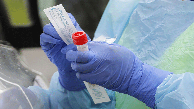 Γιατί ο ιός πλήττει περισσότερο τους υπέρβαρους άνδρες