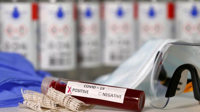 «Η επόμενη φάση θα πρέπει να είναι η σάρωση του πληθυσμού με τεστ αντισωμάτων» «Η επόμενη φάση θα πρέπει να είναι η σάρωση του πληθυσμού με τεστ αντισωμάτων»