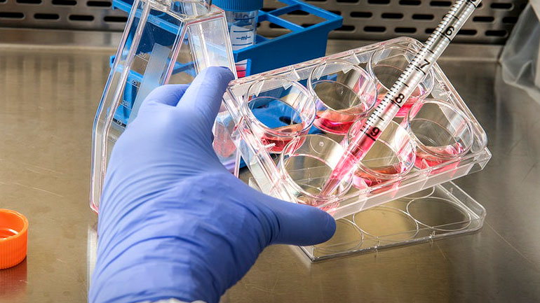 Οξεία νεφρική βλάβη εμφάνισε το 3% – 9% των ασθενών με Covid-19