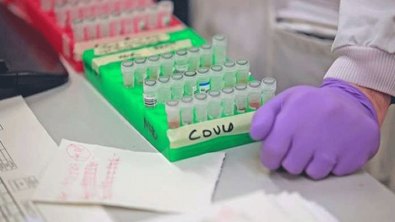 Θεσσαλία: Ξεκίνησαν οι δειγματοληπτικοί έλεγχοι για κορωνοϊό σε οικισμούς Ρομά 