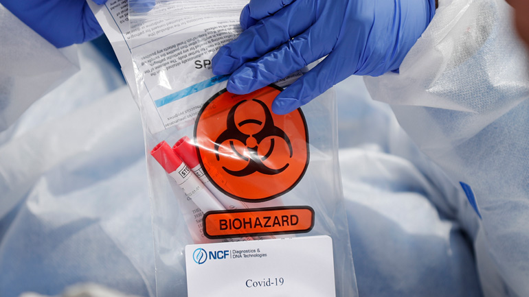 Στα 15 τα νέα κρούσματα κορωνοϊού στην Κύπρο