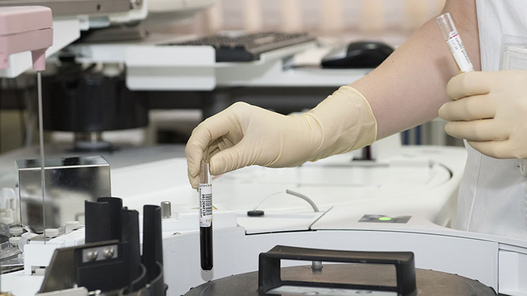 Το μεταβολικό σύνδρομο και ο ρόλος του ουρολόγου-σεξολόγου