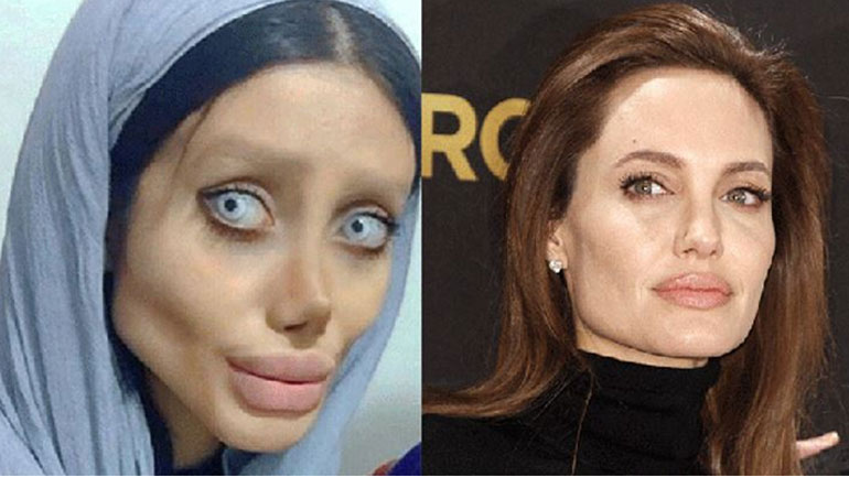 Κορωνοϊός: Σε κρίσιμη κατάσταση στο νοσοκομείο η Ιρανή «Angelina Jolie»